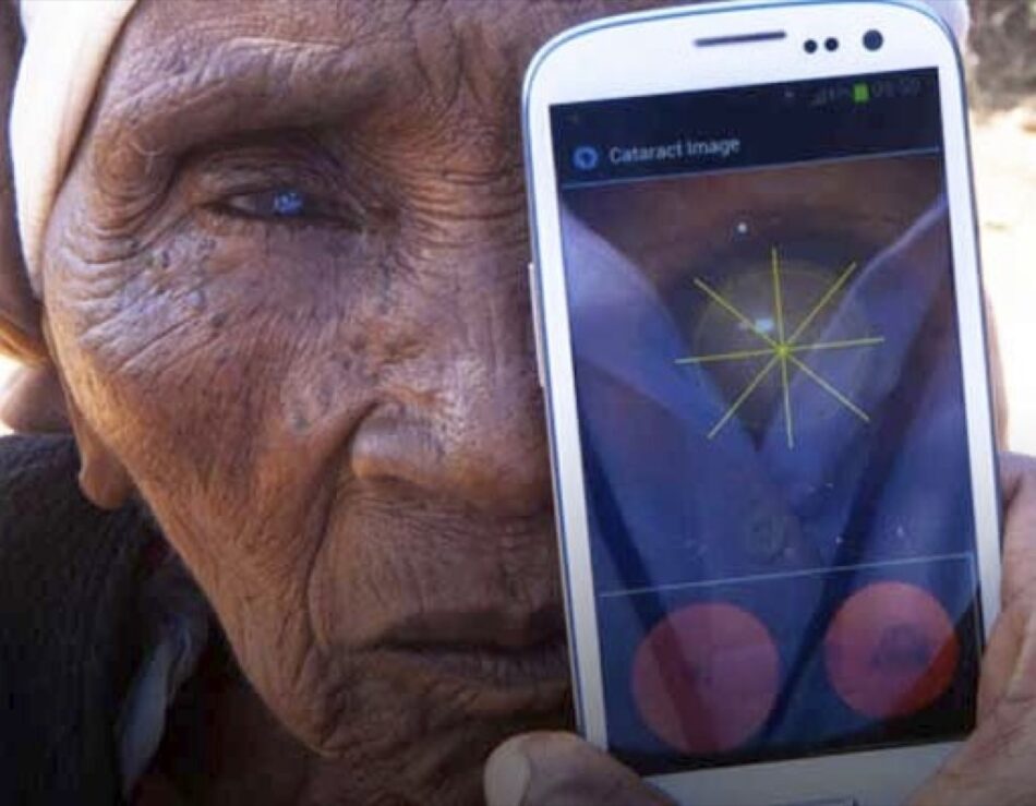 Una aplicación permite diagnosticar enfermedades oculares