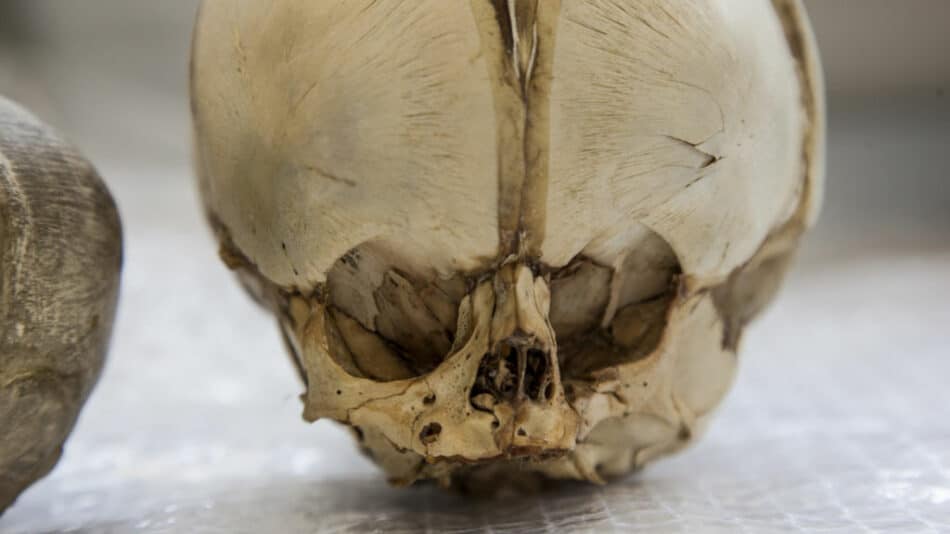 Una caja de cráneos infantiles resuelve un misterio de hace más de un siglo