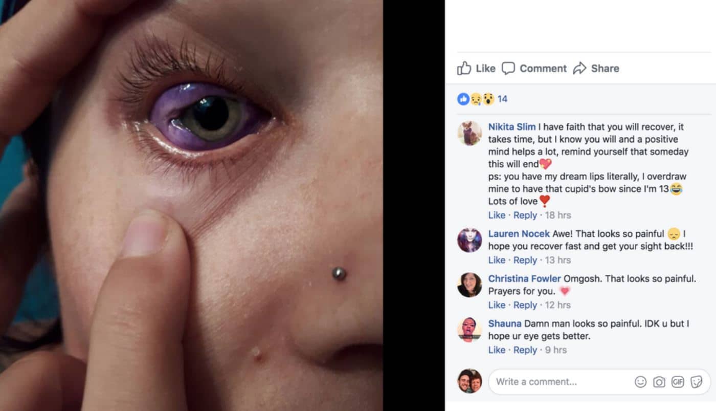 Una modelo se tatúa el ojo y ahora lucha por no perder la vista