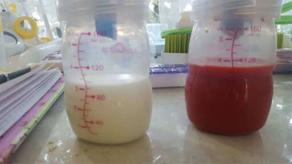 Una mujer produce leche materna de color rojo