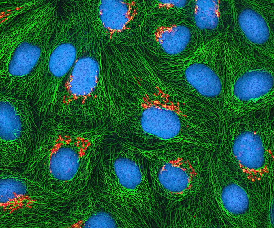 Una nueva técnica permite conocer el linaje de las células