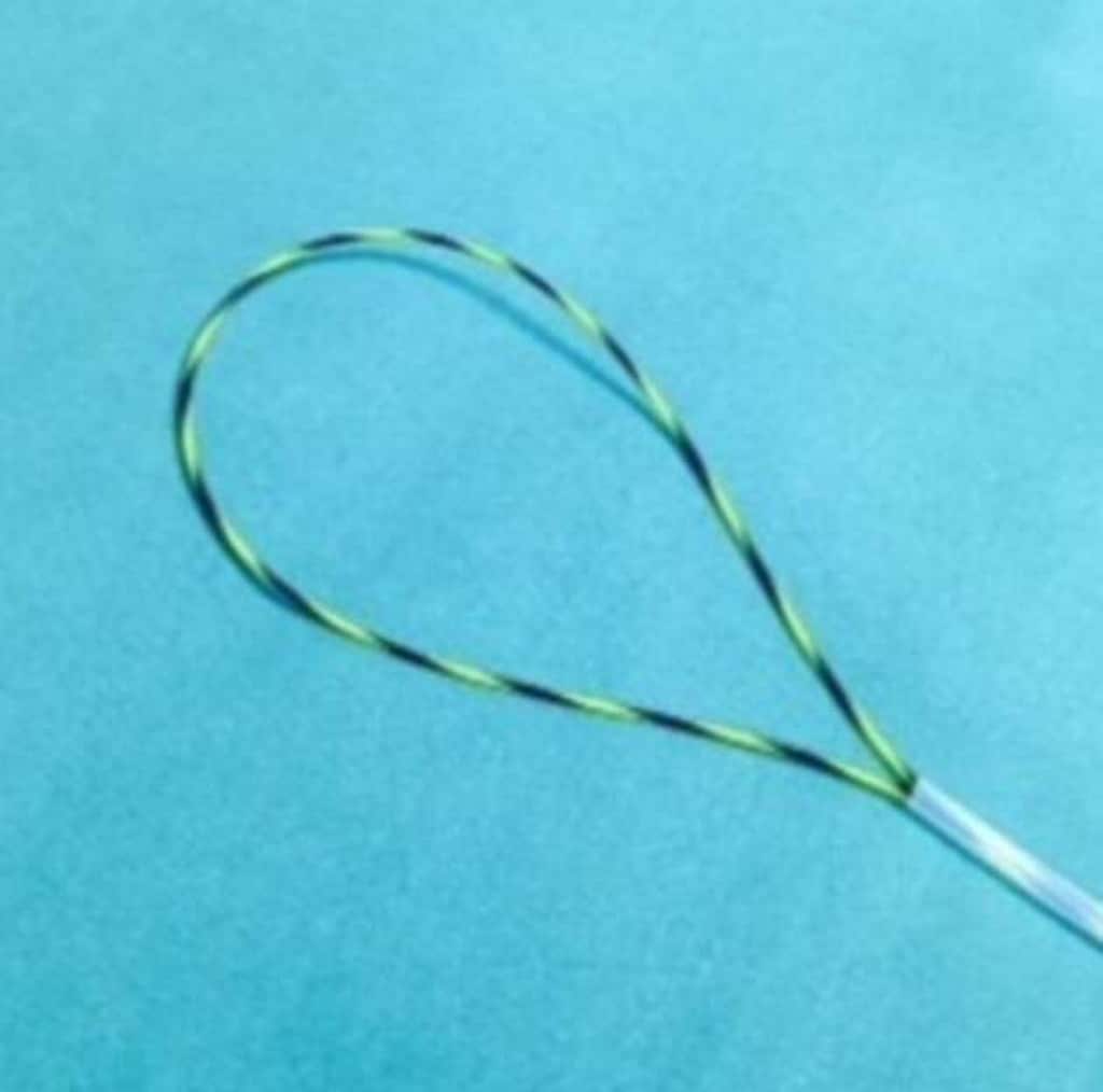 Unos médicos italianos crean un nuevo instrumento para extraer un dildo atascado en el recto