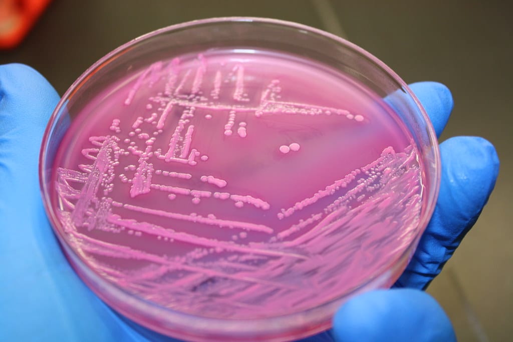 Cambio climático: ¿es esta la bacteria que estábamos esperando?