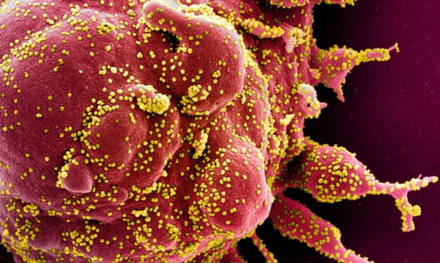 Las fotos más increíbles del coronavirus SARS-CoV-2