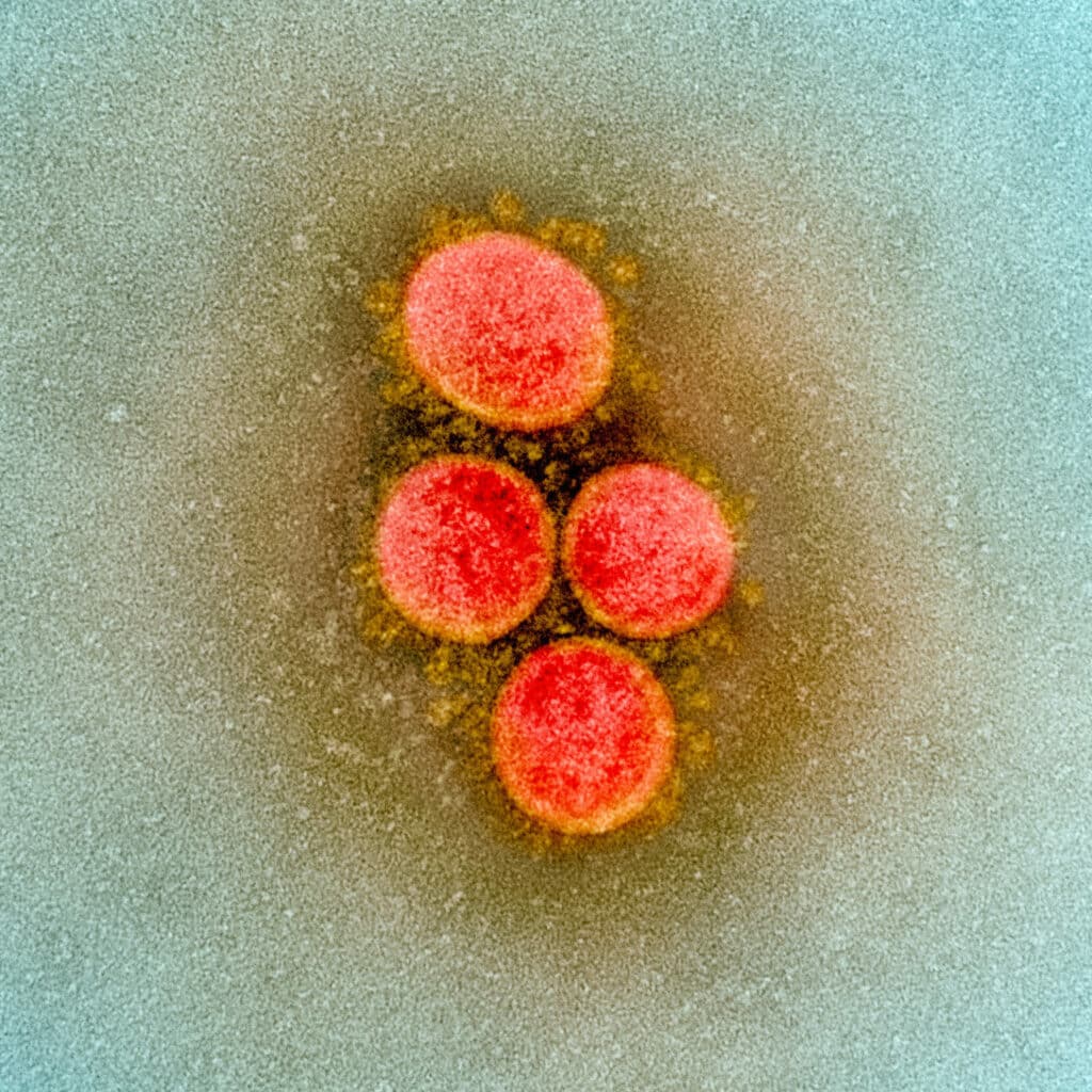 Fotografía con microscopio electrónico del coronavirus SARS-CoV-2 