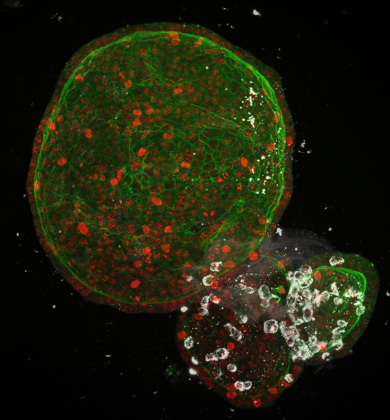 Organoides intestinales humanos infectados con SARS-CoV-2 (blanco). Crédito: Joep Beumer / grupo Clevers / Instituto Hubrecht