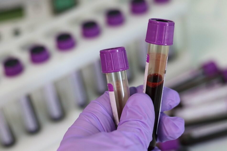 Un análisis de sangre puede detectar el cáncer con cuatro años de adelanto