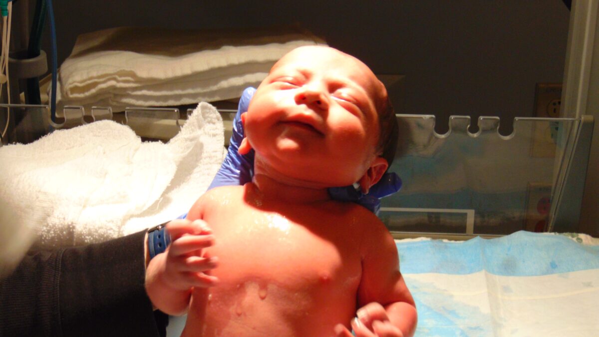Placentas artificiales para bebés prematuros extremos