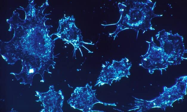 La metástasis depende de que las células cancerosas sobrevivan al viaje