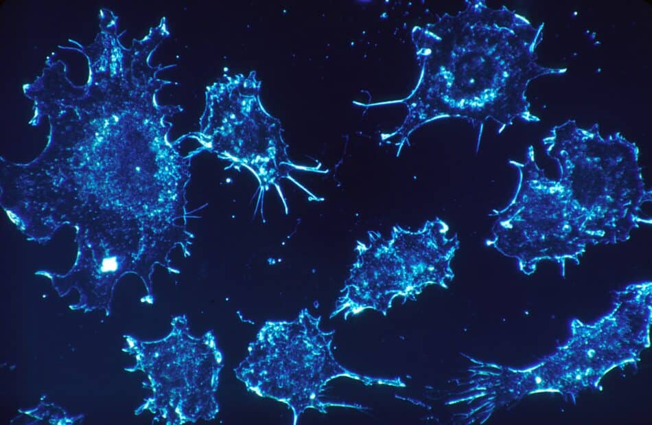 La metástasis depende de que las células cancerosas sobrevivan al viaje
