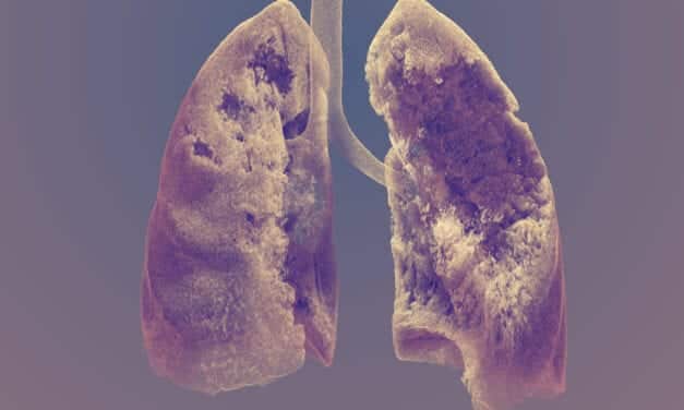 Un pulmón tras la Covid-19 gana un concurso de fotografía científica