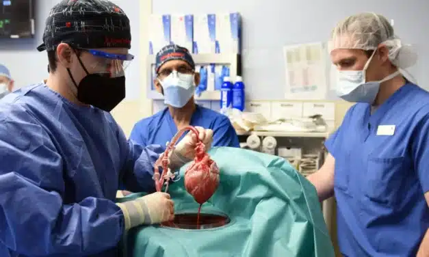 El corazón de cerdo trasplantado a un humano estaba infectado con un virus porcino