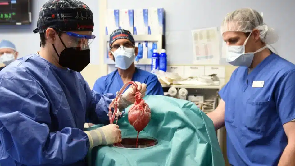 El corazón de cerdo trasplantado a un humano estaba infectado con un virus porcino