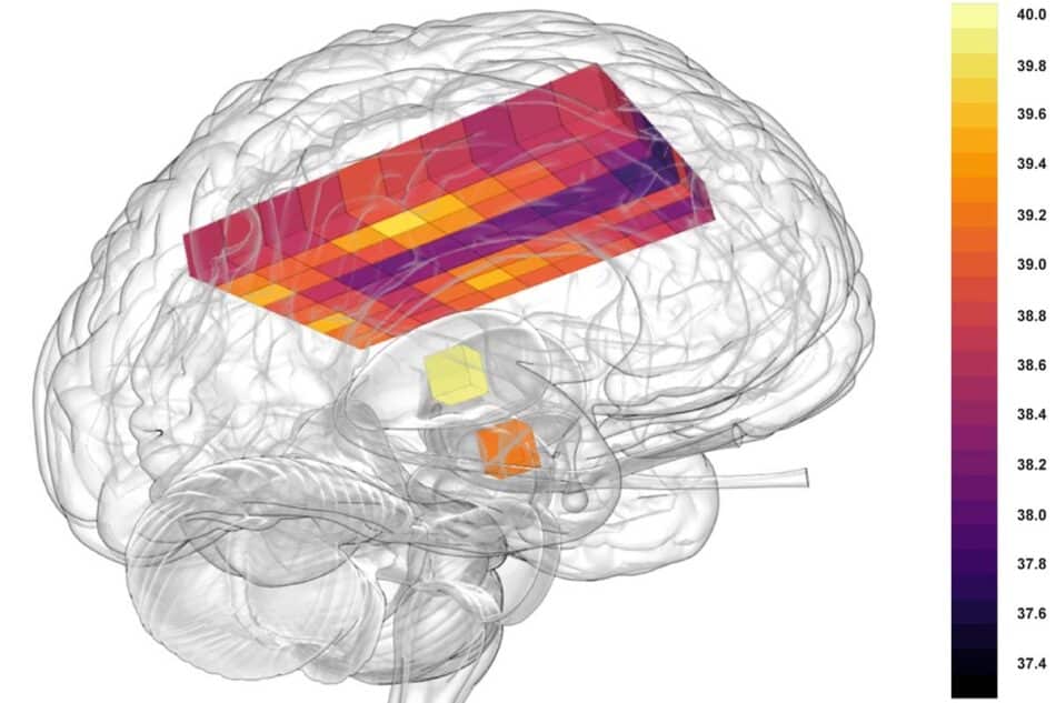 El cerebro se recalienta: más de 40 grados en su interior