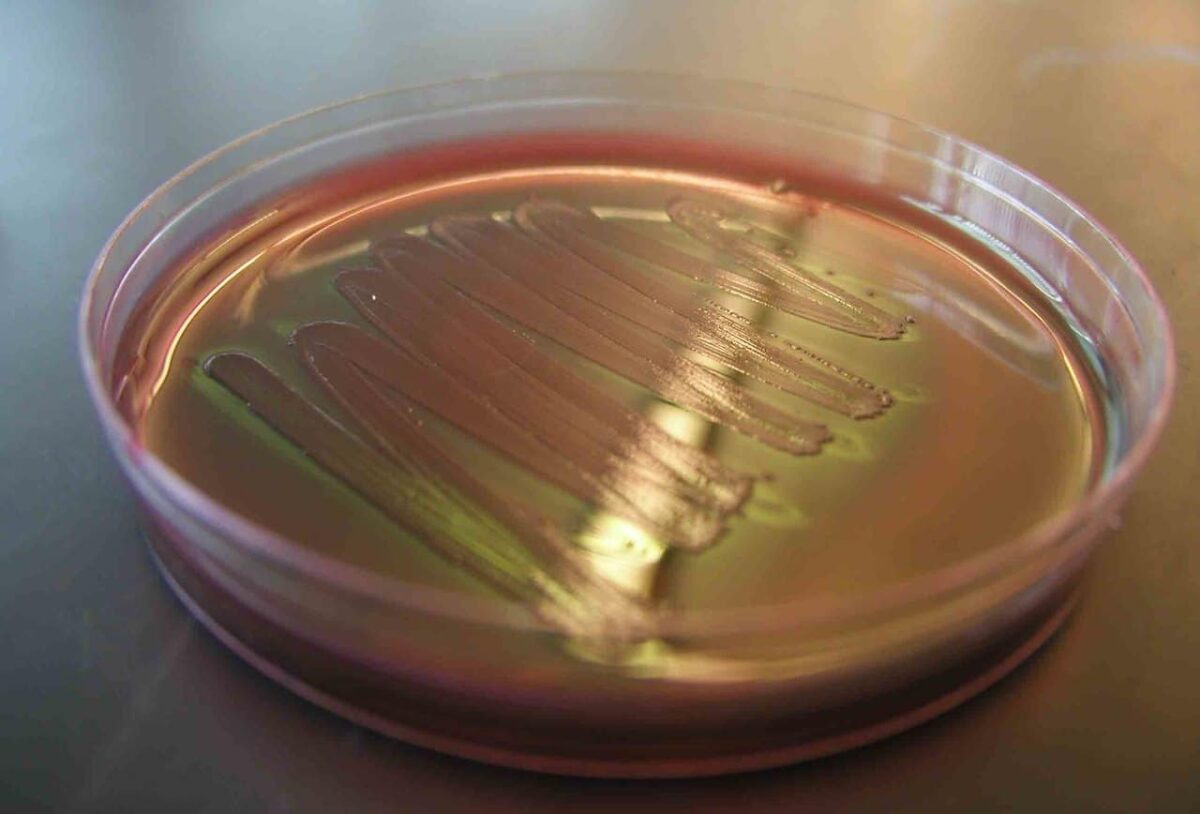 Cómo frenar a las mortíferas «superbacterias»