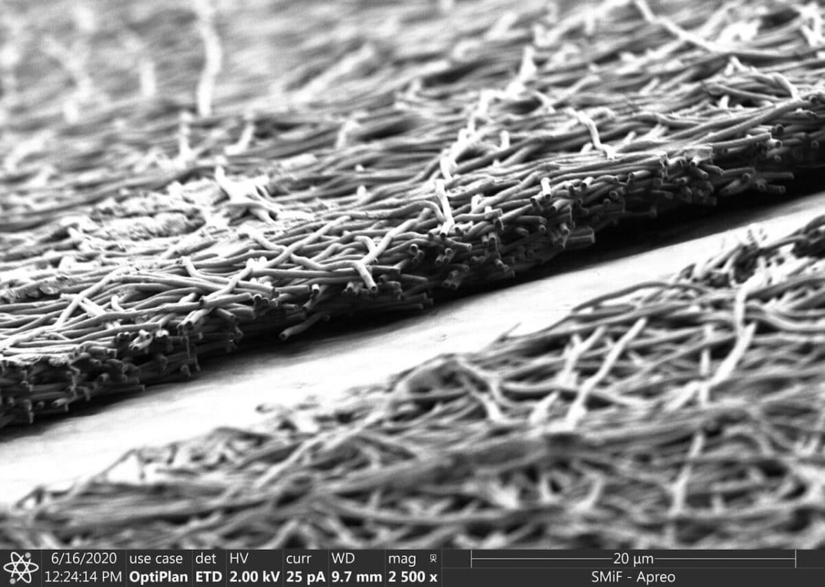 Los gusanos de seda ayudan a fabricar riñones en un chip para experimentar en los laboratorios