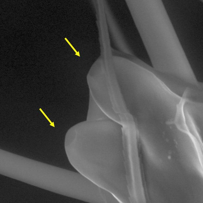 Las fosas situadas en el extremo de las antenas del mosquito protegen las estructuras en forma de pinza que detectan los infrarrojos térmicos. Crédito: DeBeaubien y Chandel et al.