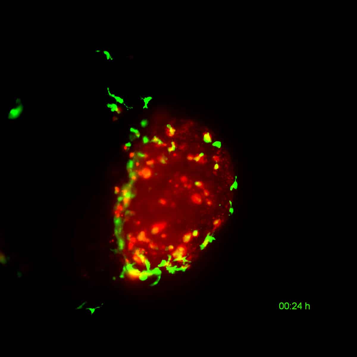 La vacuna de la tuberculosis puede ayudar a curar el cáncer