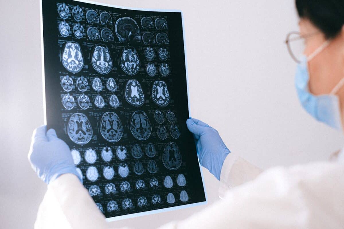 La proteína tau del Alzheimer no es tan mala como se pensaba