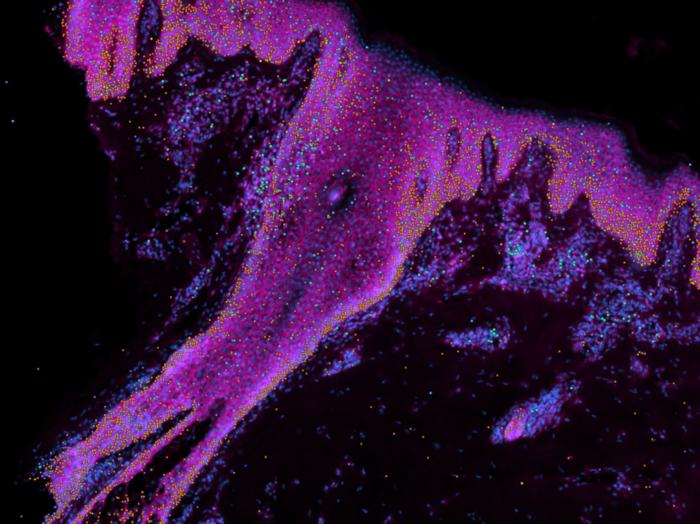 Imagen que muestra algunos genes de interés seleccionados. Cian = células madre. Naranja = queratinocitos. Verde y morado = células inmunitarias. Crédito: Instituto Wellcome Sanger