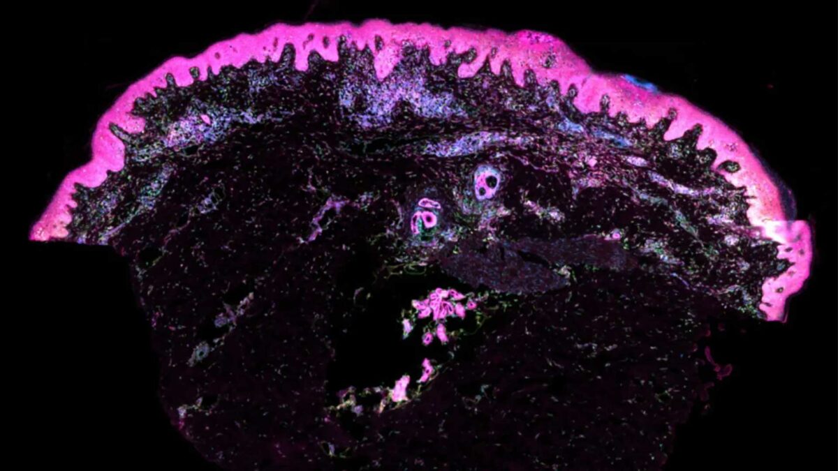 Un mapa de la piel humana podría acabar con las cicatrices y hacer crecer el pelo