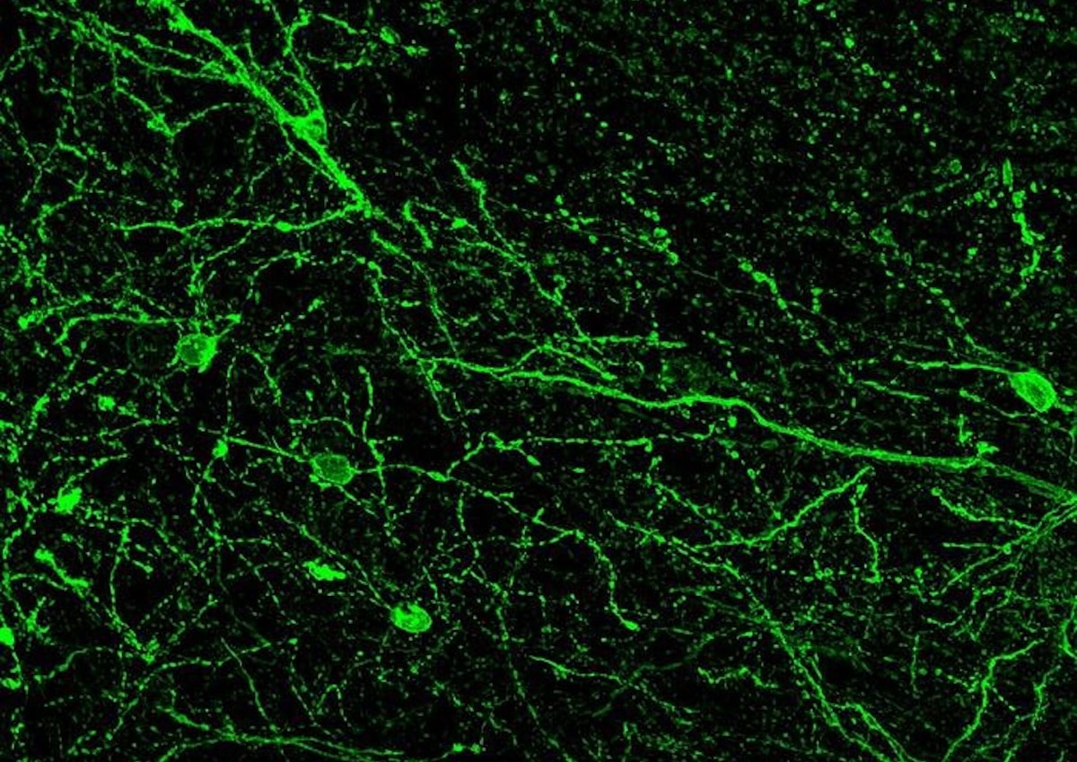 ¿Cómo funciona la empatía en el cerebo?