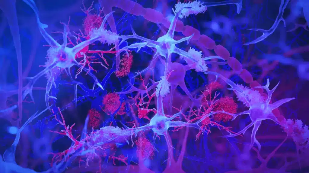 El sorprendente vínculo entre las infecciones intestinales y el Alzheimer 1 microglía