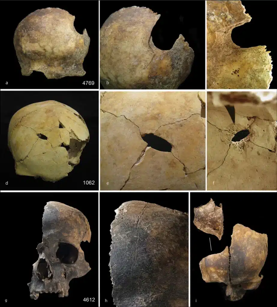 Múltiples cráneos del yacimiento muestran dónde los atacantes asestaron golpes mortales a las víctimas. Schulting et al. 2024