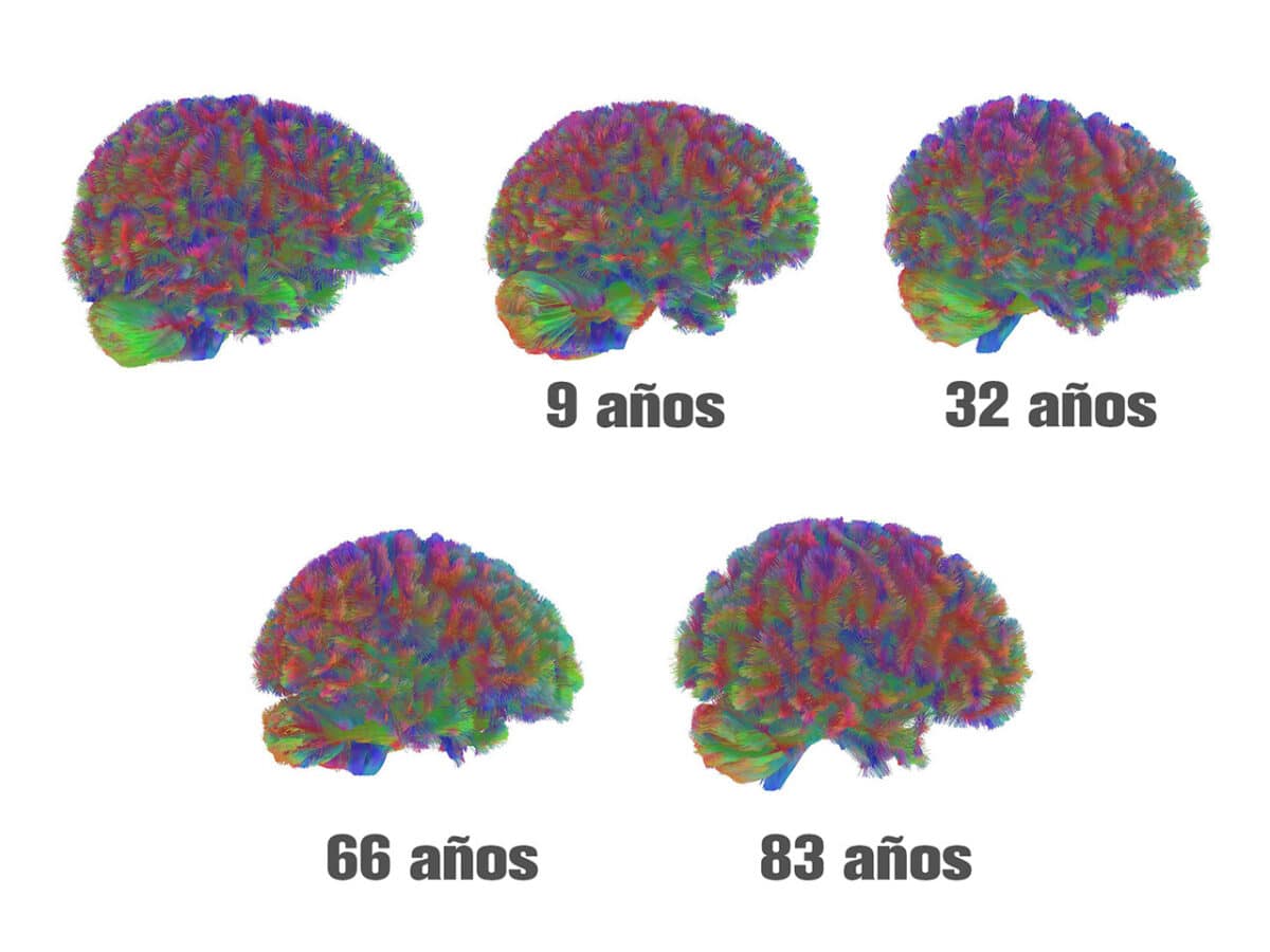Las edades del cerebro: hasta los 32 años eres un adolescente