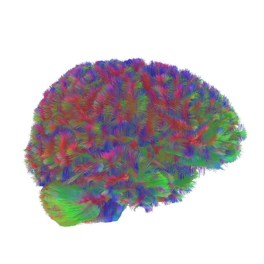 edades del cerebro 1
