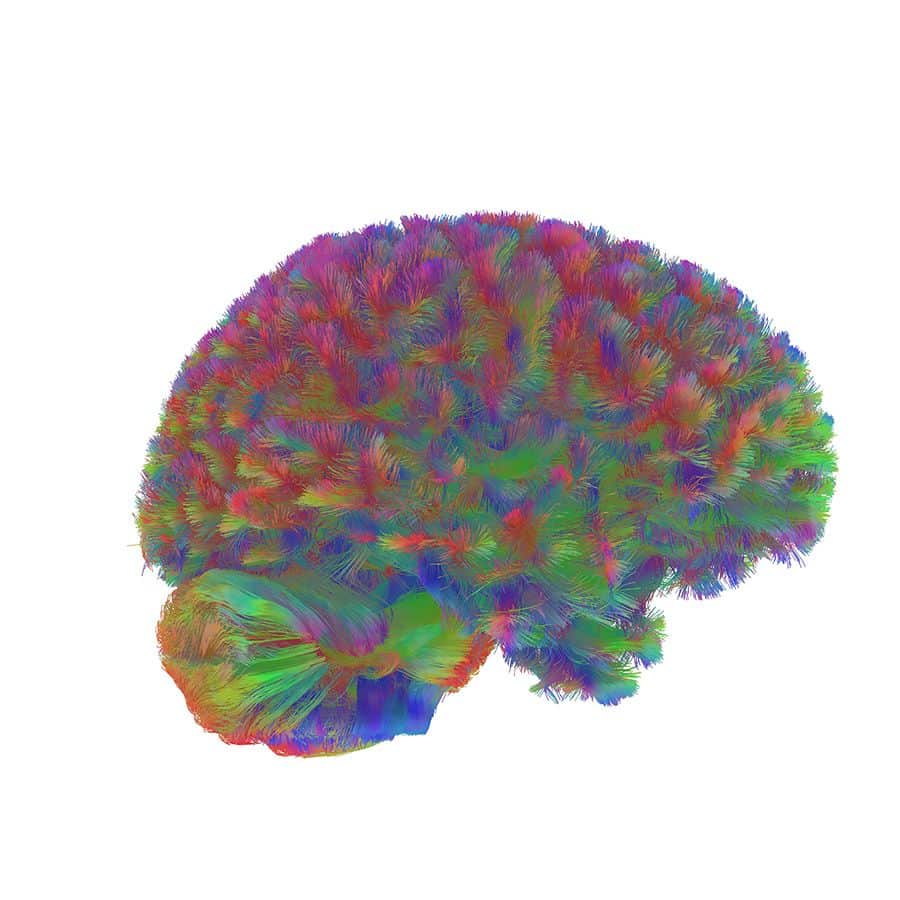 edades del cerebro 2