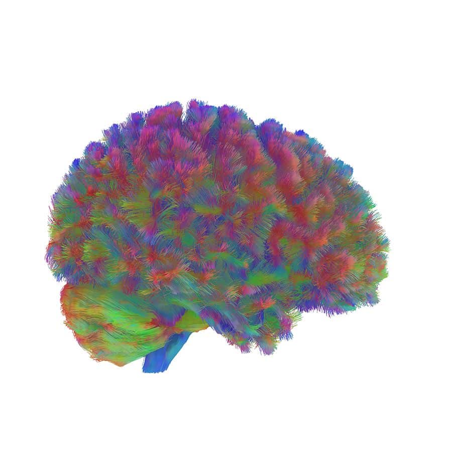 edades del cerebro 3