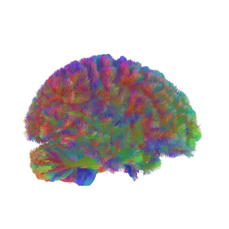 edades del cerebro 4