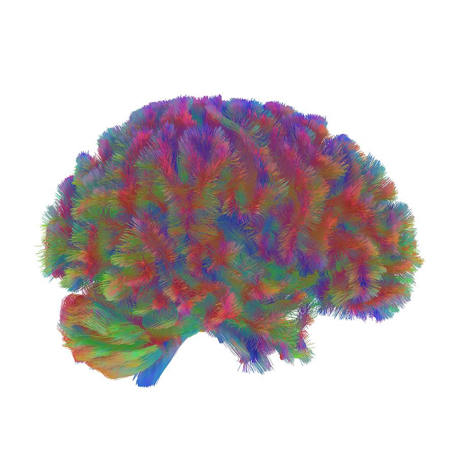 edades del cerebro 5