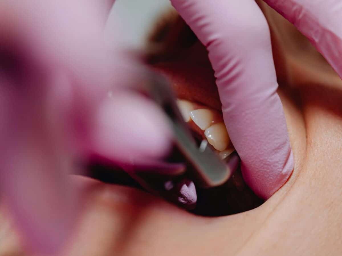 Por qué los dientes se caen más en los hombres que en las mujeres