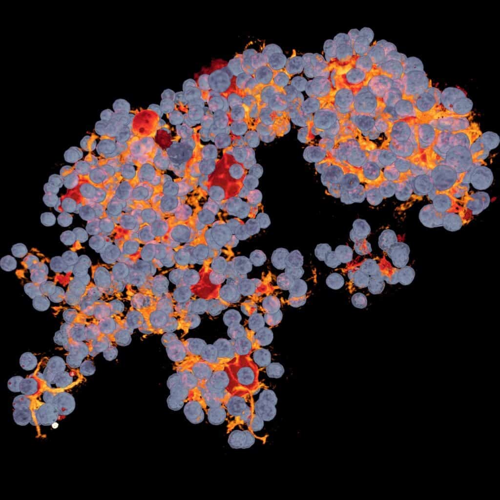 Organoide con células del hígado