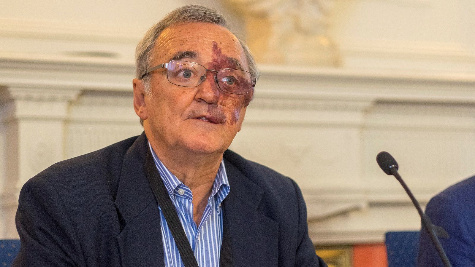 Mariano Barbacid y su equipo consiguen curar el cáncer de páncreas en ratones