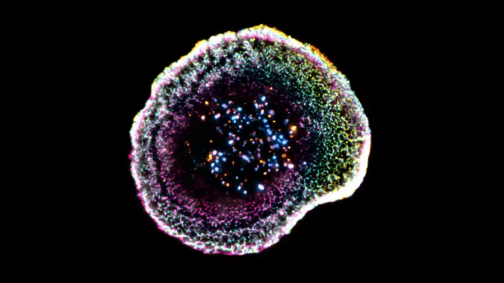 Por primera vez vemos en 3D cómo un linfocitos T mata células cancerosas 1 Una célula T citotóxica captada mediante microscopía de criocontracción (cryo-ExM). Los puntos de colores que se observan en el centro son gránulos citotóxicos que se utilizan para destruir células infectadas o cancerosas. © F. Lemaitre @ UNIGE