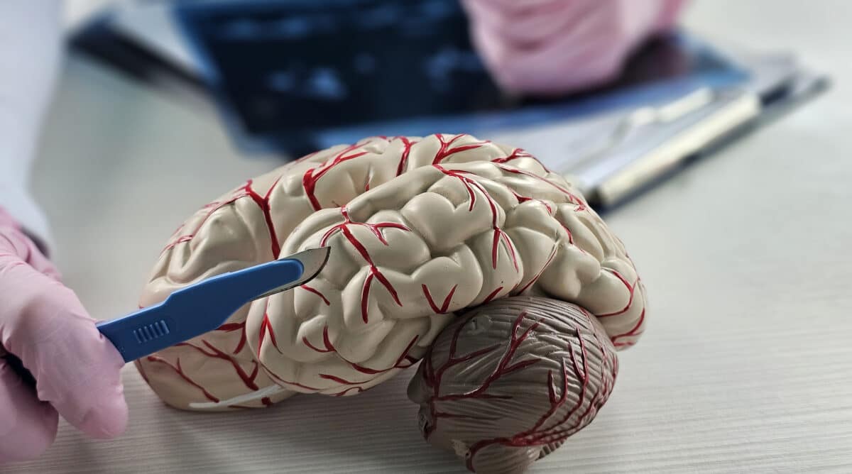 Así es como tu cerebro aprende mientras estás anestesiado