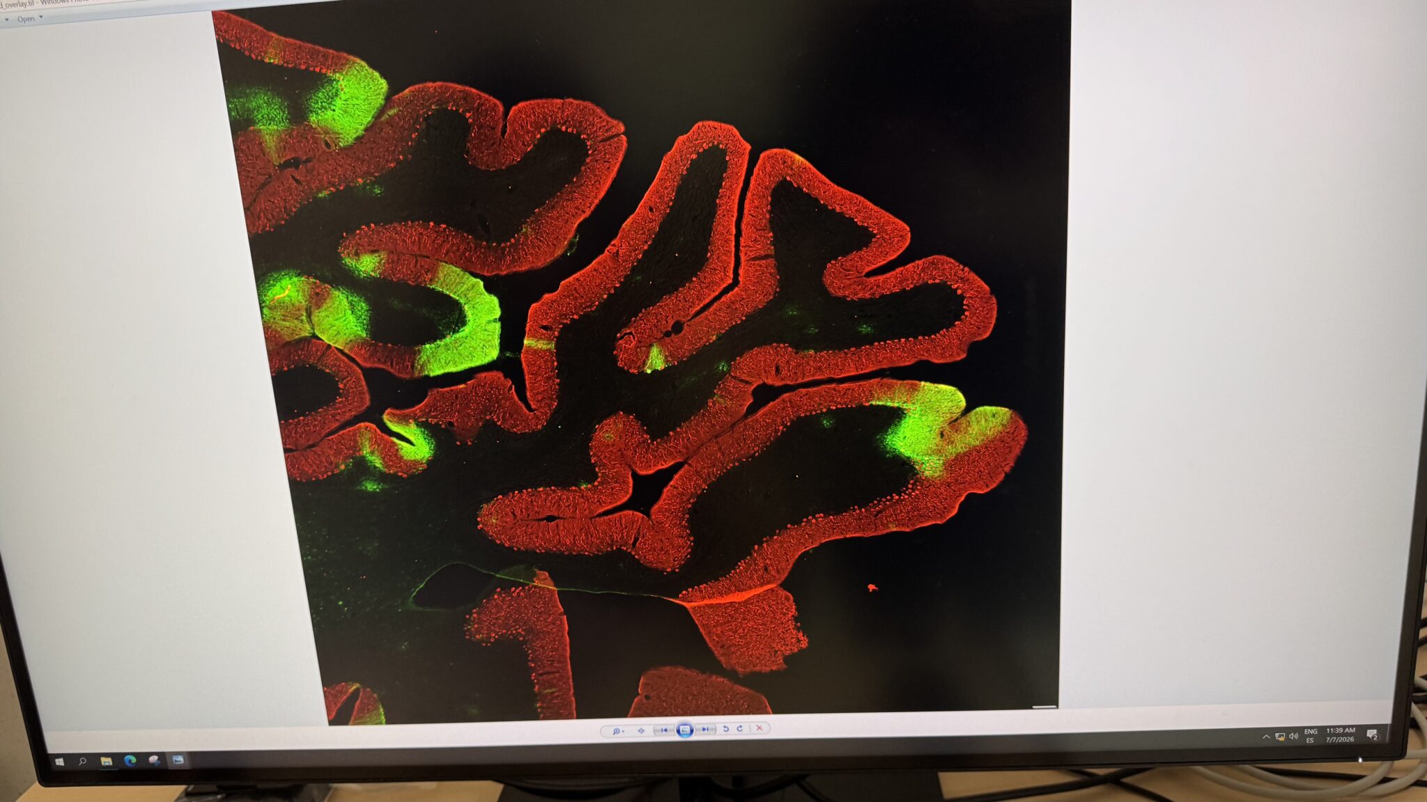 Javier Blesa, neurocientífico de CINAC "Nuestro objetivo es curar la enfermedad de Parkinson" 3 Un corte del cerebelo muestra proteínas que han atravesado la barrera hematoencefálica, un paso crucial para el tratamiento del Parkinson