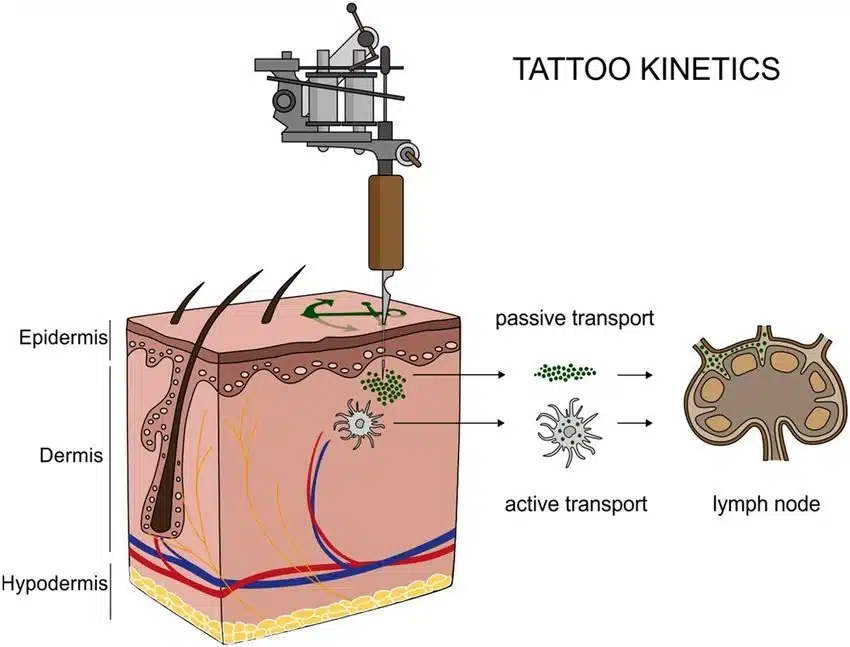 La tinta de los tatuajes se acumula en los ganglios linfáticos: esto es lo que hace con tu sistema inmune 2 Traslado de partículas de tatuaje desde la piel a los ganglios linfáticos. Tras la inyección de las tintas de tatuaje, las partículas pueden ser transportadas de forma pasiva a través de la sangre y la linfa, o bien ser fagocitadas por las células inmunitarias y, posteriormente, depositadas en los ganglios linfáticos regionales. Una vez cicatrizado el tatuaje, las partículas permanecen en la dermis y en los sinusoides de los ganglios linfáticos drenantes.