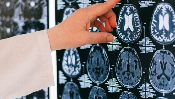 pexels shvetsa 4226119 ¿Por qué el lado derecho del cerebro controla el izquierdo del cuerpo?